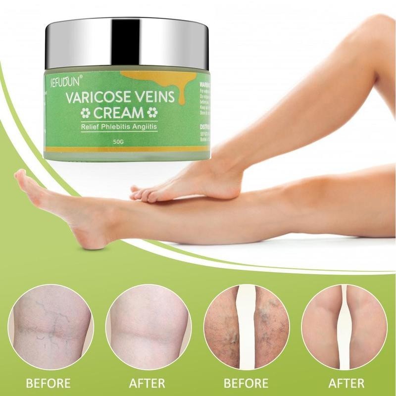 Vein Cream Red Blood Streaks Repair Earthworm Leg Bruises Bulge Relief Pain Safflower Skin care lotion Varicose Cream
